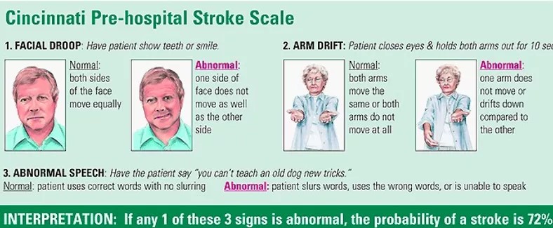 stroke scale blog image
